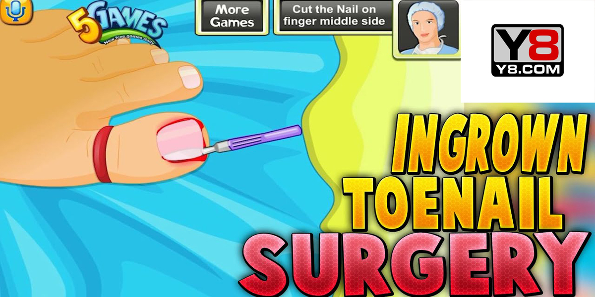 Ingrown Toenail Surgery